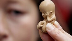 В Ирландии запланировали референдум по отмене запрета на аборты