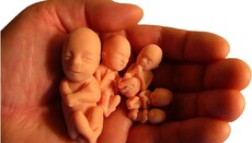 В Ирландии собрались провести референдум об отмене запрета на аборты